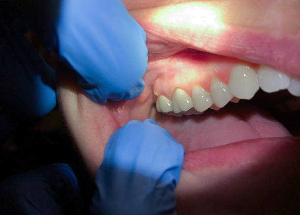 Best Emergency TMJ Treatment in Lockport, IL