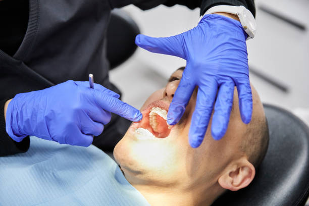 Best Emergency Dental Care for Broken or Chipped Teeth in Lockport, IL