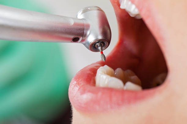 Best Emergency Treatment for Dental Infections or Abscesses in Lockport, IL